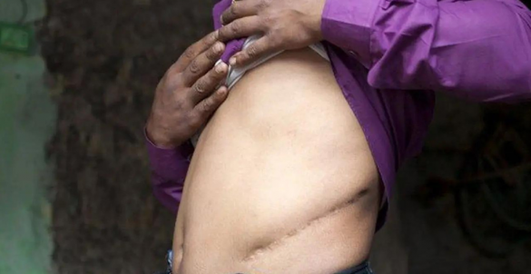 Forced organ harvesting, a chilling and growing industry
